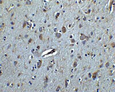 Immunohistochemistry: TET3 Antibody - BSA Free [NBP2-82066]