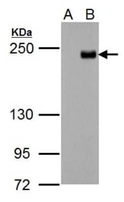 Western Blot: TET3 Antibody [NBP2-20603]