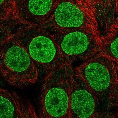 Immunocytochemistry/ Immunofluorescence: TETRAN Antibody [NBP2-47607]