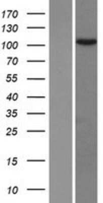 Western Blot: TEX10 Overexpression Lysate [NBP2-06930]