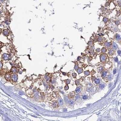 Immunohistochemistry-Paraffin: TEX101 Antibody [NBP1-84356]