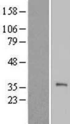 Western Blot: TEX101 Overexpression Lysate [NBL1-16819]