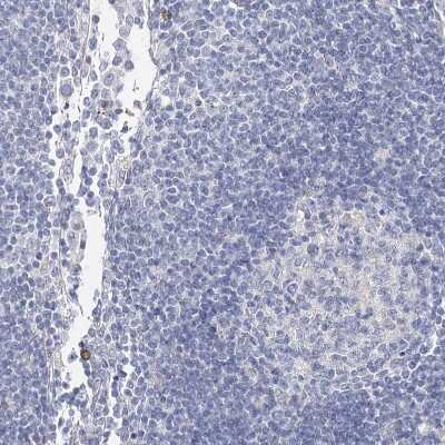 Immunohistochemistry-Paraffin: TEX12 Antibody [NBP1-90989]