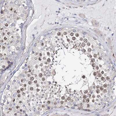 Immunohistochemistry-Paraffin: TEX12 Antibody [NBP1-90989]