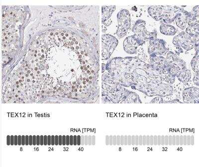 Immunohistochemistry-Paraffin: TEX12 Antibody [NBP1-90989]