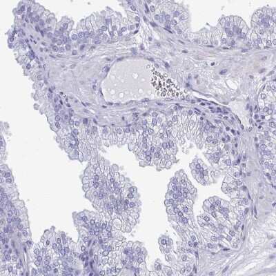 Immunohistochemistry-Paraffin: TEX12 Antibody [NBP2-32656]