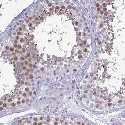 Immunohistochemistry-Paraffin: TEX12 Antibody [NBP2-32656]