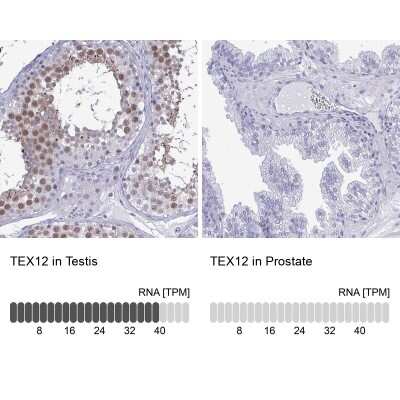 Immunohistochemistry-Paraffin: TEX12 Antibody [NBP2-32656]