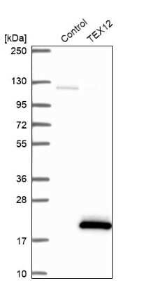 Western Blot: TEX12 Antibody [NBP2-32656]