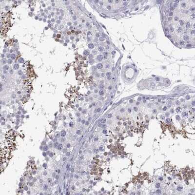 Immunohistochemistry-Paraffin: TEX13A Antibody [NBP2-62675]