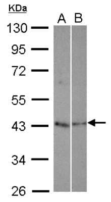 Western Blot: TEX13A Antibody [NBP2-15138]