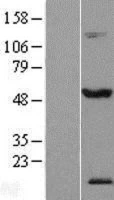 Western Blot: TEX13A Overexpression Lysate [NBL1-16822]