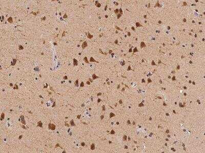 Immunohistochemistry-Paraffin: TEX13B Antibody [NBP3-06129]