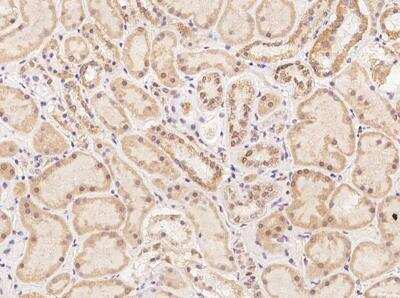 Immunohistochemistry-Paraffin: TEX13B Antibody [NBP3-06129]