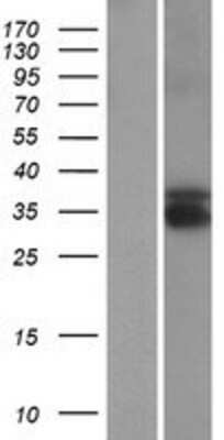 Western Blot: TEX13B Overexpression Lysate [NBP2-06148]