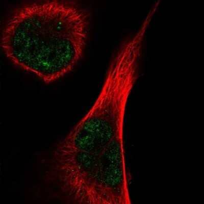 Immunocytochemistry/ Immunofluorescence: TEX15 Antibody [NBP2-58059]