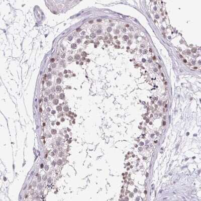 Immunohistochemistry-Paraffin: TEX15 Antibody [NBP1-84347]