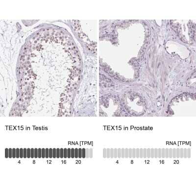 Immunohistochemistry-Paraffin: TEX15 Antibody [NBP1-84347]