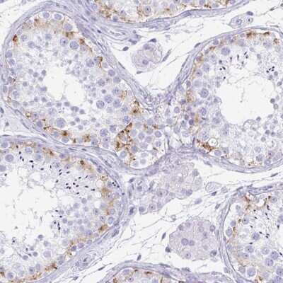 Immunohistochemistry-Paraffin: TEX19 Antibody [NBP2-30835]
