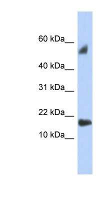 Western Blot: TEX19 Antibody [NBP1-56811]