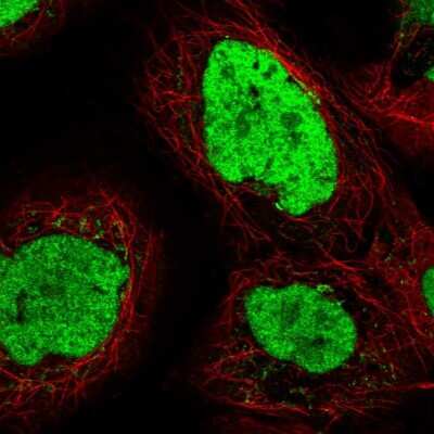 Immunocytochemistry/ Immunofluorescence: TEX2 Antibody [NBP2-55394]