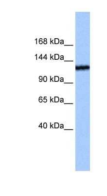 Western Blot: TEX2 Antibody [NBP1-59977]