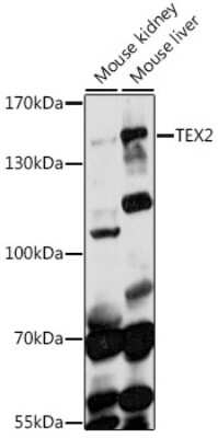 Western Blot: TEX2 AntibodyAzide and BSA Free [NBP2-93786]