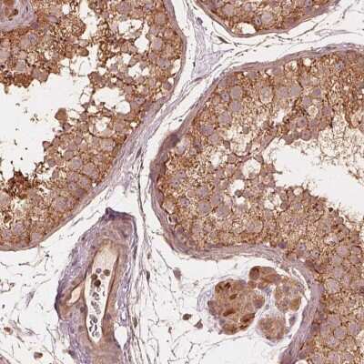 Immunohistochemistry: TEX22 Antibody [NBP2-38069]