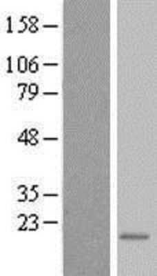 Western Blot: TEX261 Overexpression Lysate [NBP2-05564]