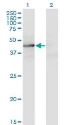 Western Blot: TEX28 Antibody (1A8) [H00001527-M05]