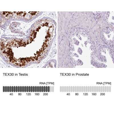 Immunohistochemistry-Paraffin: TEX30 Antibody [NBP2-30640]