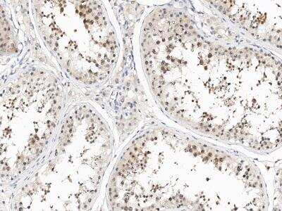 Immunohistochemistry-Paraffin: TEX30 Antibody [NBP3-14645]