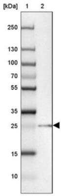 Western Blot: TEX30 Antibody [NBP2-30640]