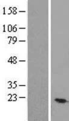 Western Blot: TEX30 Overexpression Lysate [NBL1-08160]