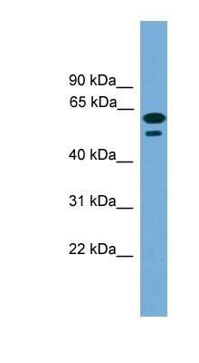 Western Blot: TEX45 Antibody [NBP1-91471]