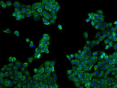 Immunocytochemistry/ Immunofluorescence: TEX9 Antibody [NBP3-06298]