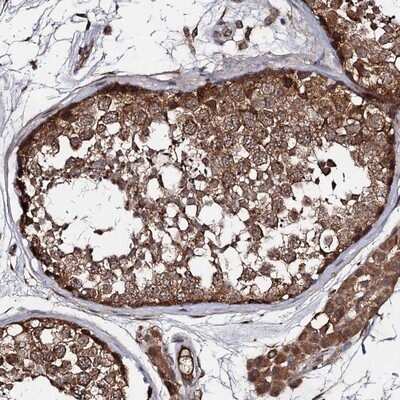 Immunohistochemistry-Paraffin: TEX9 Antibody [NBP1-86249]