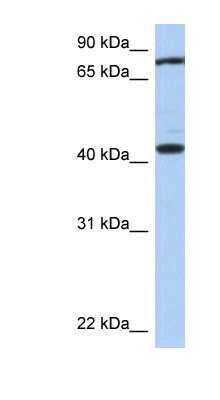 Western Blot: TEX9 Antibody [NBP1-56553]