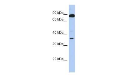 Western Blot: TEX9 Antibody [NBP2-85901]