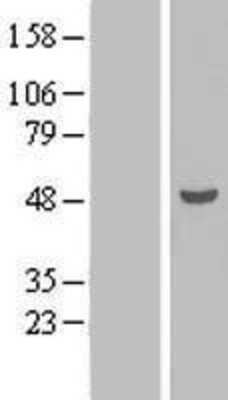 Western Blot: TEX9 Overexpression Lysate [NBL1-16826]