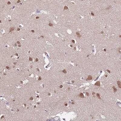 Immunohistochemistry-Paraffin: TFAP2D Antibody [NBP2-13428]