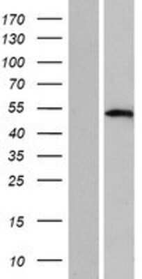 Western Blot: TFAP2D Overexpression Lysate [NBP2-05173]