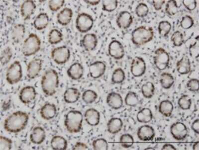Immunohistochemistry-Paraffin: TFAP4 Antibody (8G6) [H00007023-M05]