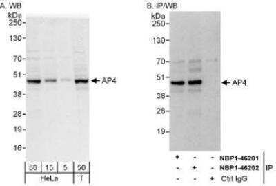 Western Blot: TFAP4 Antibody [NBP1-46202]