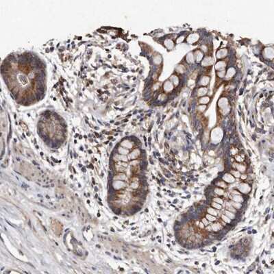 Immunohistochemistry-Paraffin: TFB1M Antibody [NBP2-13429]