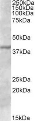 Western Blot: TFB1M Antibody [NBP1-51978]