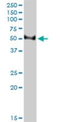 Western Blot: TFB2M Antibody (2E10) [H00064216-M01]