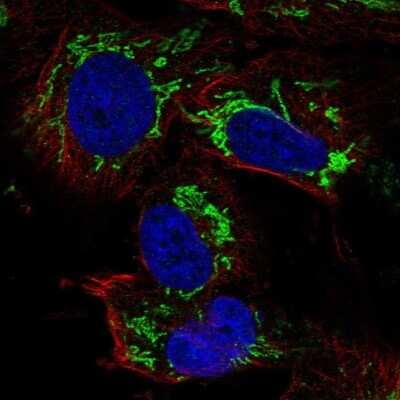 Immunocytochemistry/ Immunofluorescence: TFB2M Antibody [NBP2-68602]