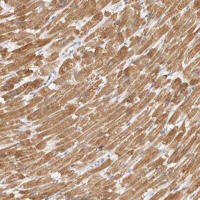 Immunohistochemistry: TFB2M Antibody [NBP1-82114]