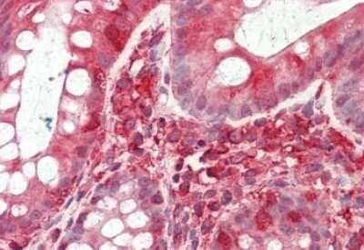 Immunohistochemistry-Paraffin: TFB2M Antibody [NBP1-78283]
